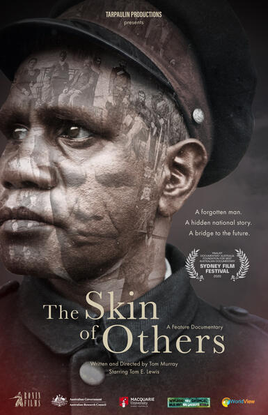 Skin of others (The)